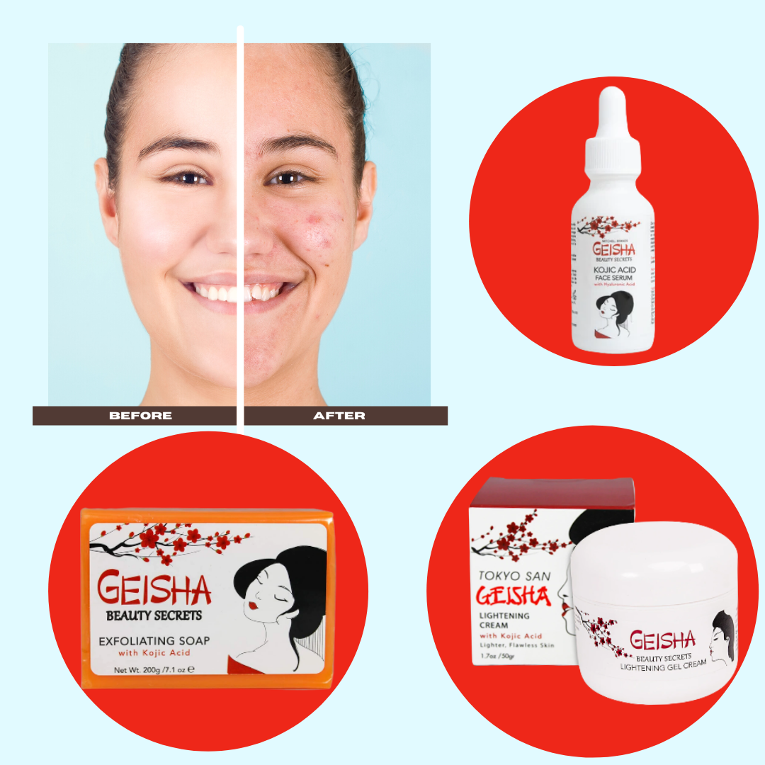 All About Kojic Acid: The Brightening Beauty Ingredient You Need in Your Skincare Toolkit