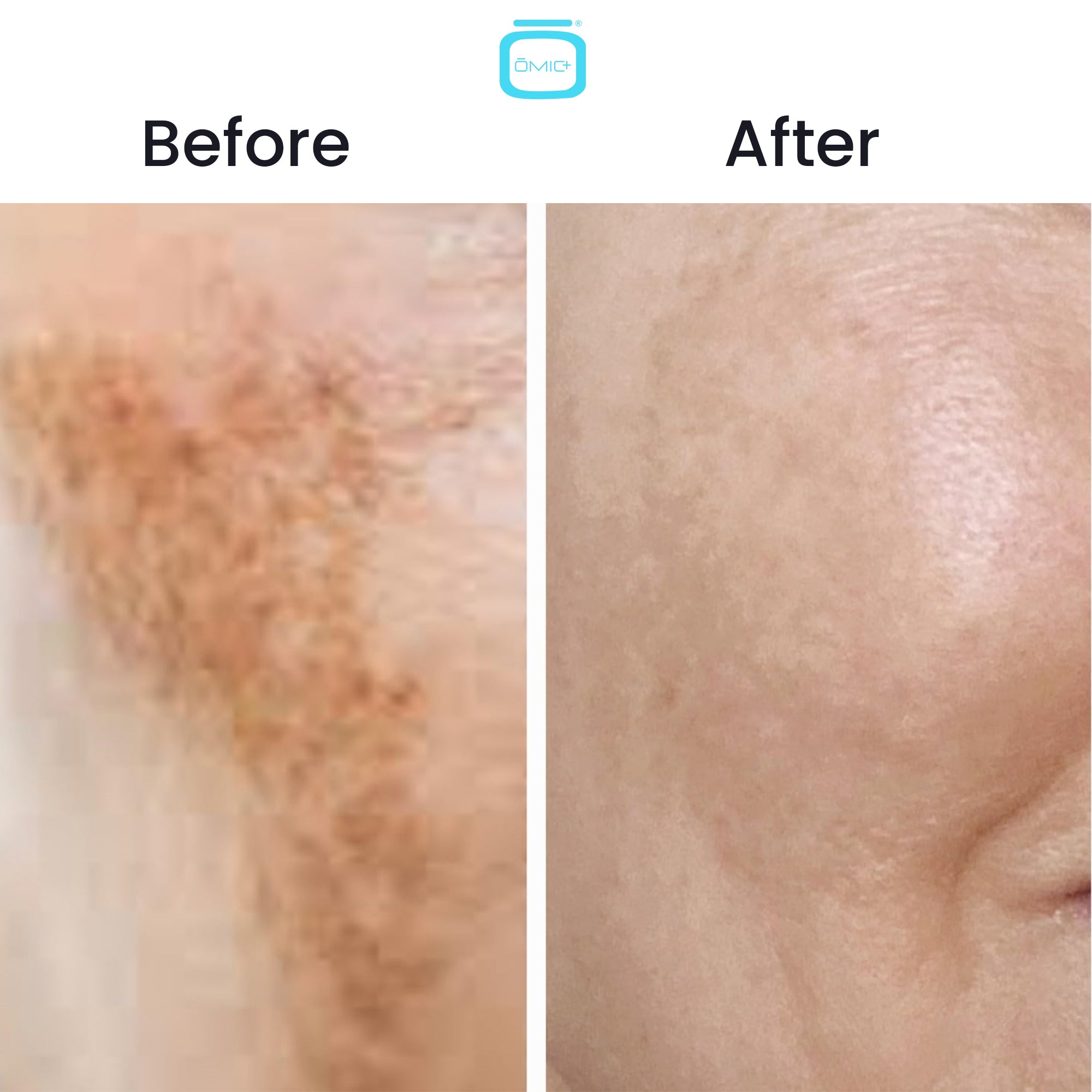 Omic+ 10% Tranexamic Acid Cream 30ml