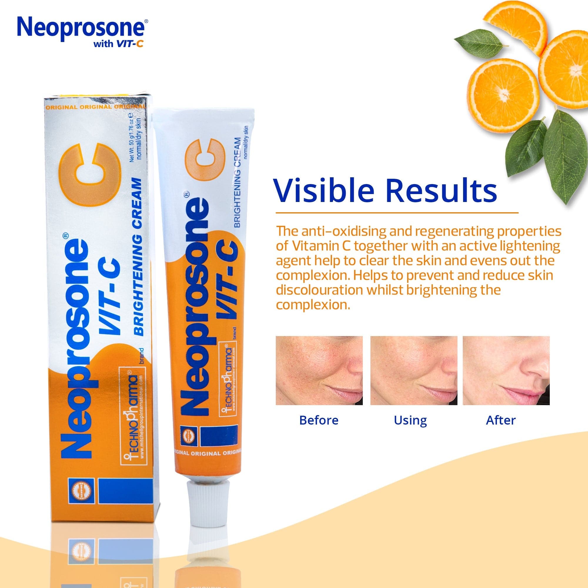 Neoprosone Brightening Cream with Vitamin C - 50g / 1.75 Fl Oz Neoprosone Vitamin "C" - Mitchell Brands - Skin Lightening, Skin Brightening, Fade Dark Spots, Shea Butter, Hair Growth Products