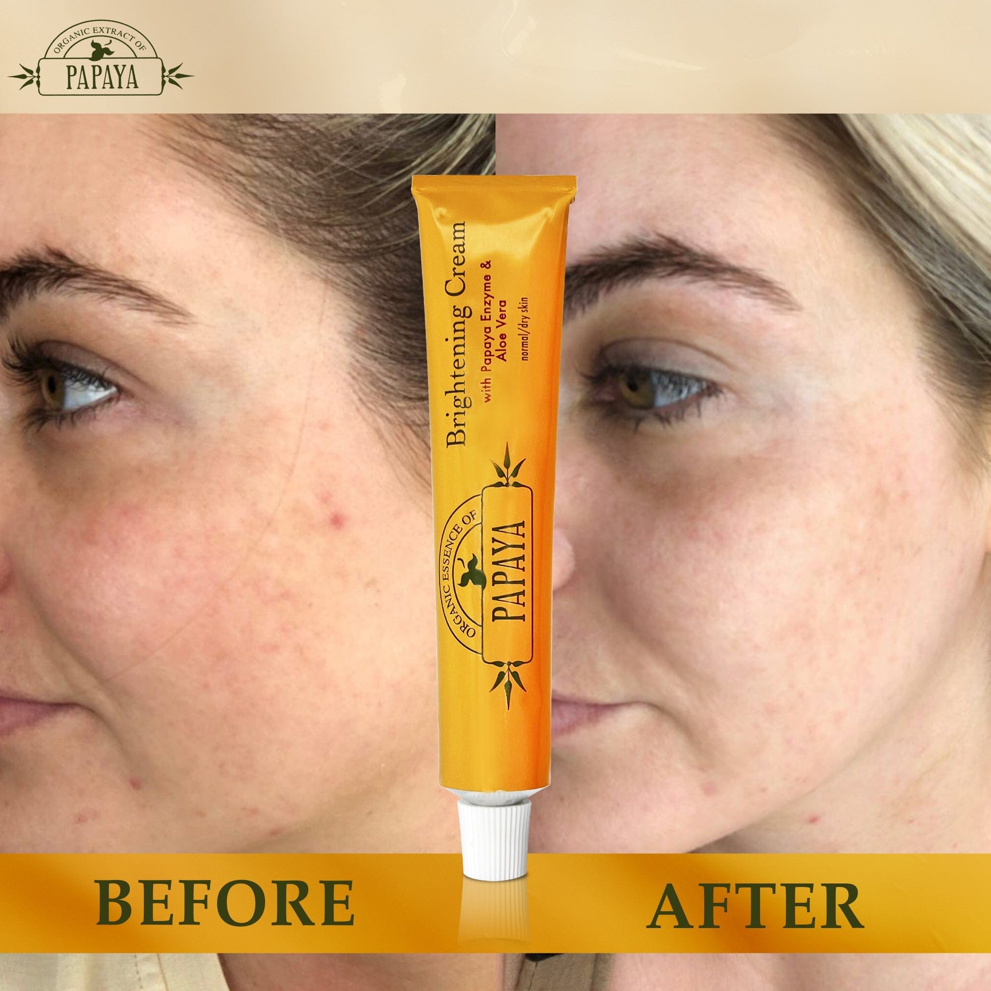 Organic Extract of Papaya Brightening Cream Tube - 50g / 1.76 Oz FleurDeLis - Mitchell Brands - Skin Lightening, Skin Brightening, Fade Dark Spots, Shea Butter, Hair Growth Products