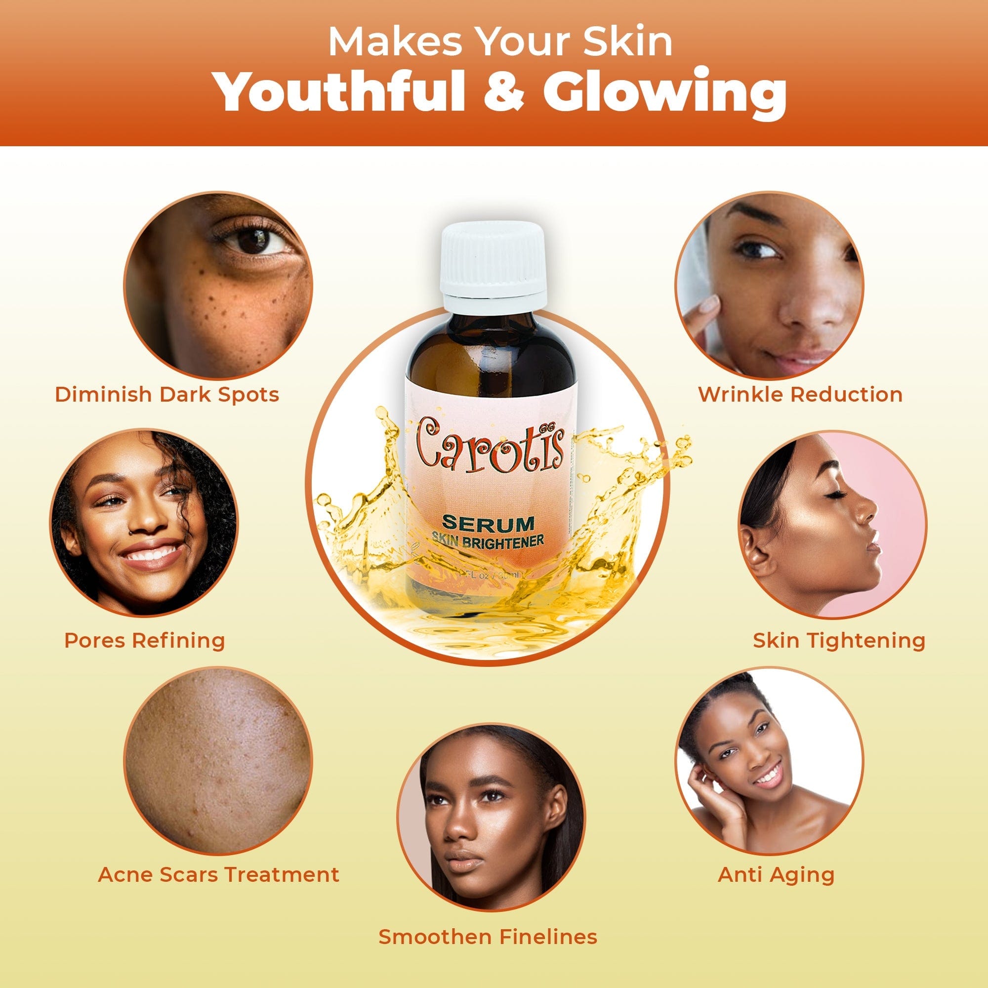 Carotis Brightening Serum - 30ml / 1 fl oz Carotis - Mitchell Brands - Skin Lightening, Skin Brightening, Fade Dark Spots, Shea Butter, Hair Growth Products