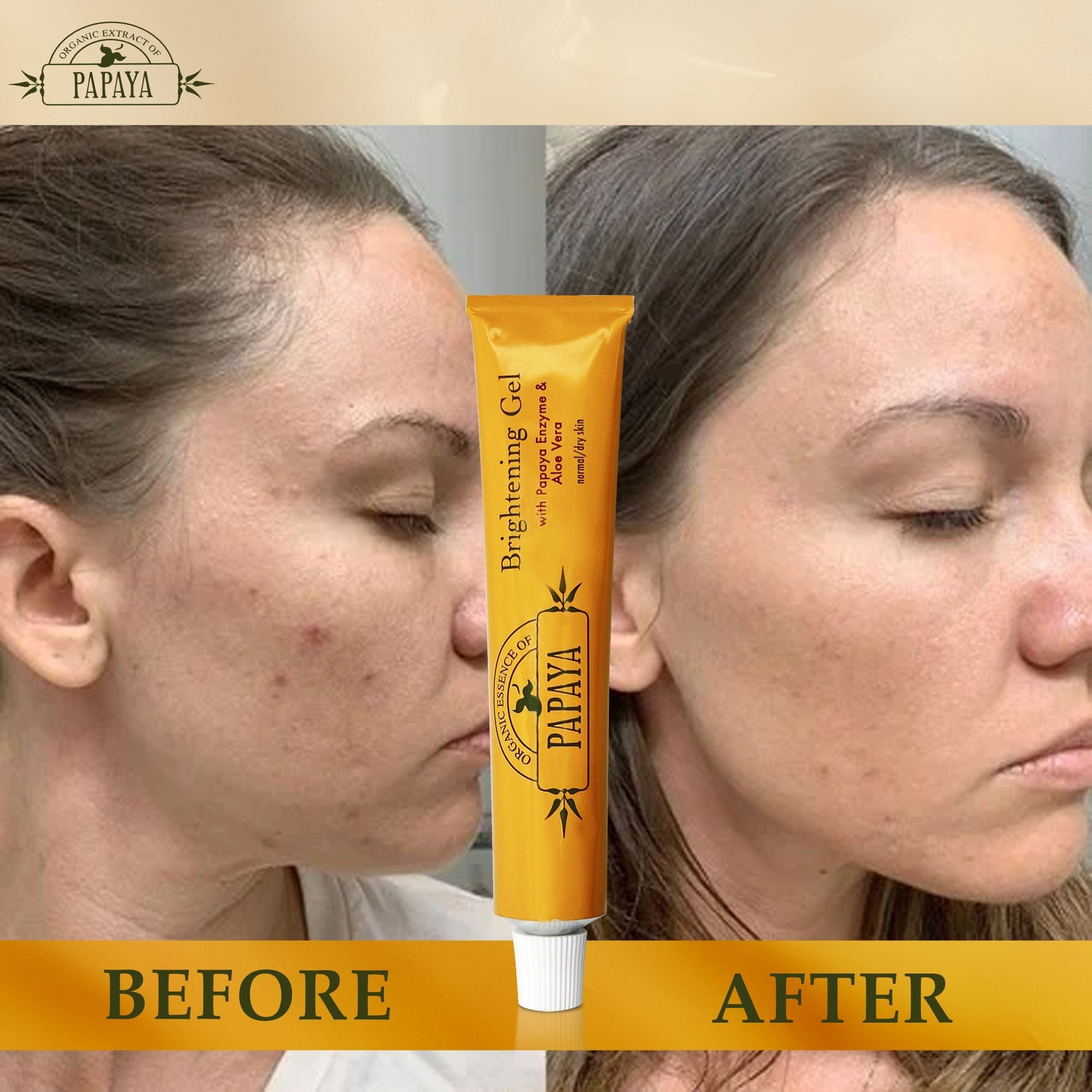 Organic Extract of Papaya Brightening Gel Tube - 30g / 1 Oz FleurDeLis - Mitchell Brands - Skin Lightening, Skin Brightening, Fade Dark Spots, Shea Butter, Hair Growth Products