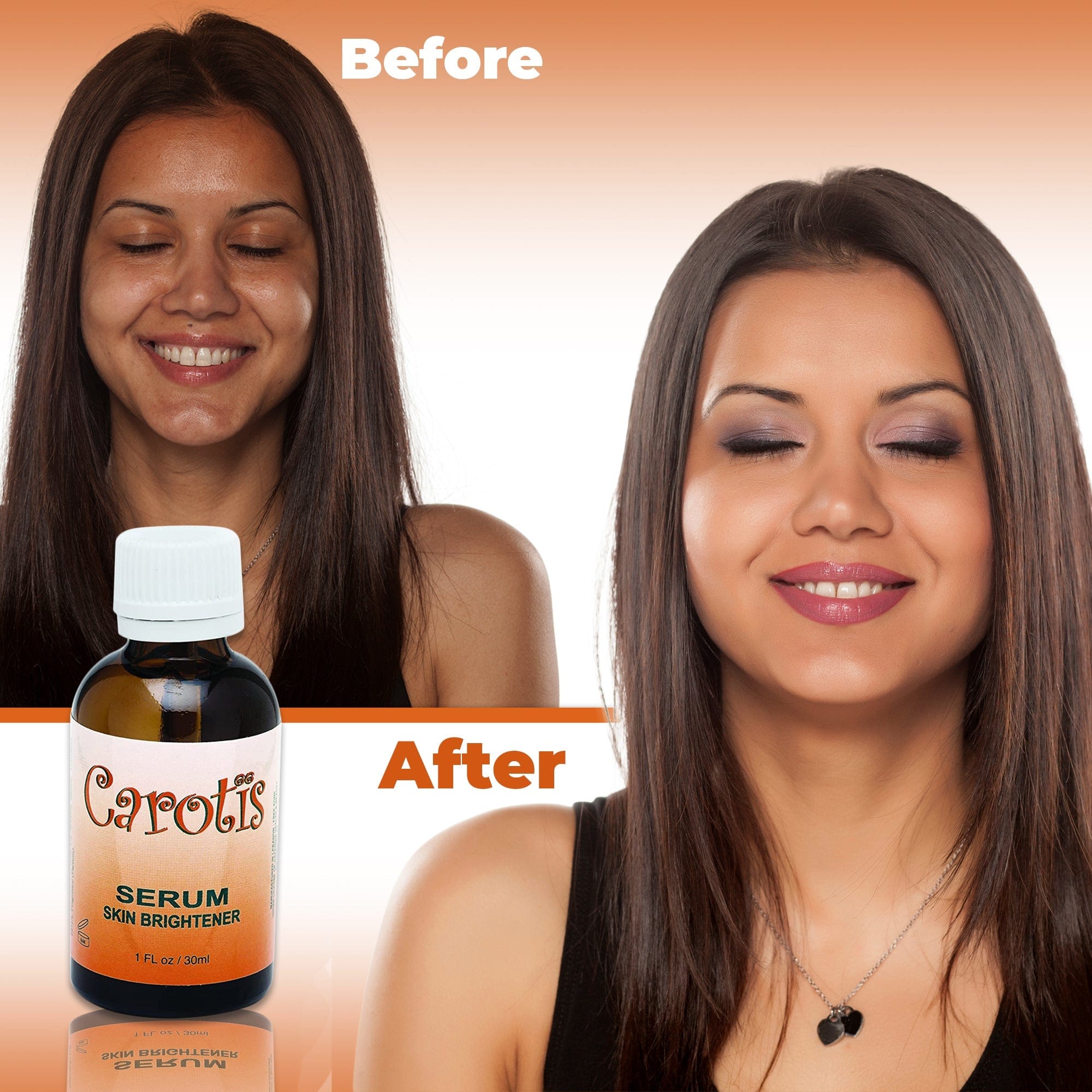 Carotis Brightening Serum - 30ml / 1 fl oz Carotis - Mitchell Brands - Skin Lightening, Skin Brightening, Fade Dark Spots, Shea Butter, Hair Growth Products