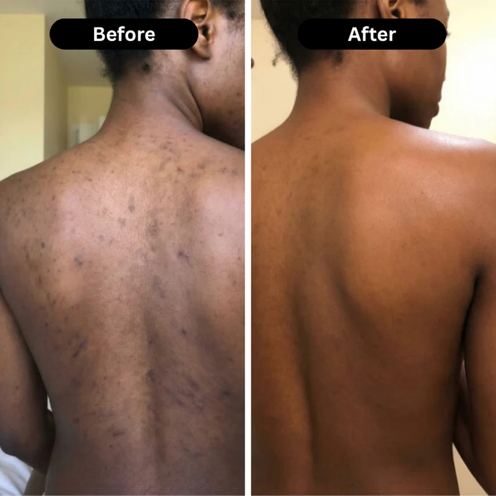 Customer before and after result