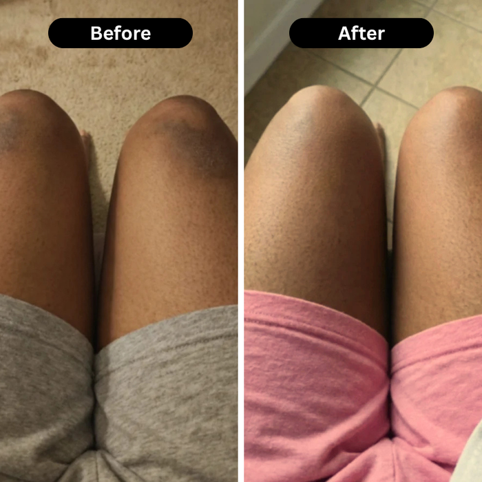 Customer before and after result