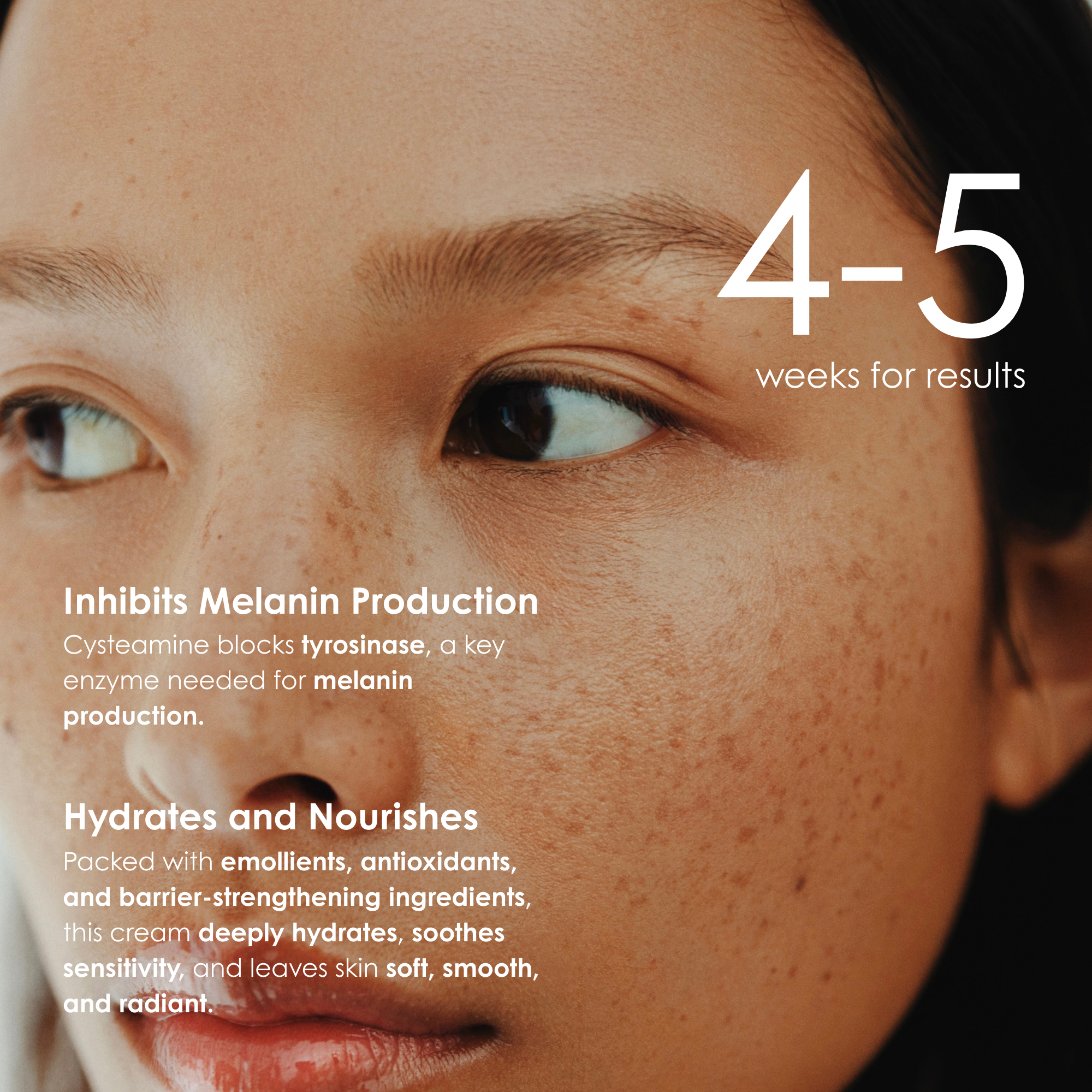 Omic+ 7.5% Cysteamine Cream 30ml - omicskincare