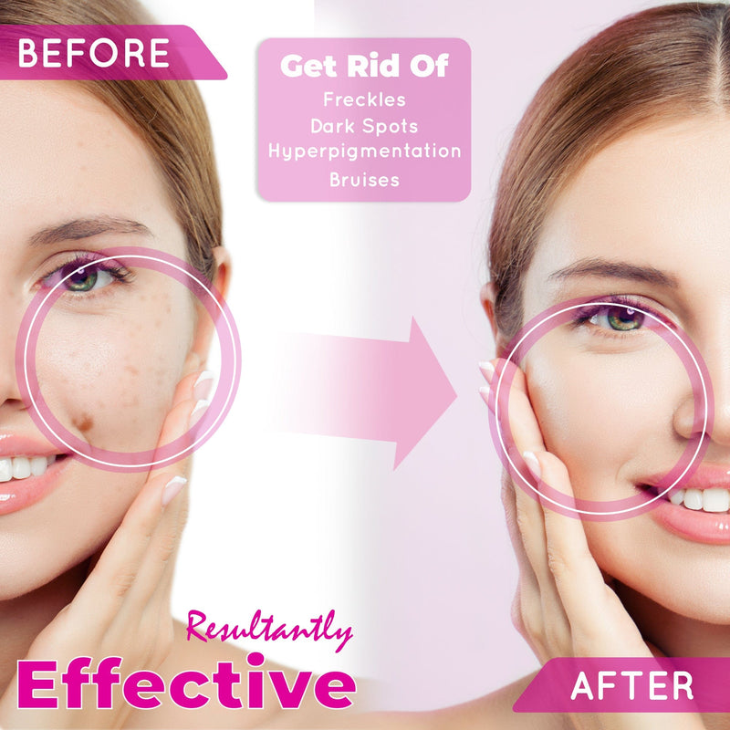 So White Skin Perfector Dark Spot Corrector Gel 30ml