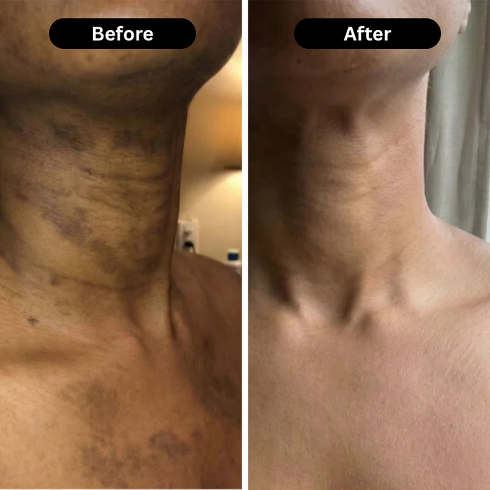 Customer before and after result