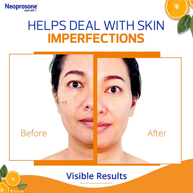 Neoprosone Dark Spot Corrector Cream With Vitamin C 30ml / 1 fl oz