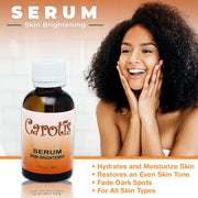Carotis Brightening Serum - 30ml / 1 fl oz Carotis - Mitchell Brands - Skin Lightening, Skin Brightening, Fade Dark Spots, Shea Butter, Hair Growth Products