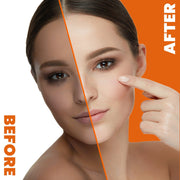 Neoprosone Brightening Gel with Vitamin C – 30g / 1 Fl Oz Neoprosone Vitamin "C" - Mitchell Brands - Skin Lightening, Skin Brightening, Fade Dark Spots, Shea Butter, Hair Growth Products