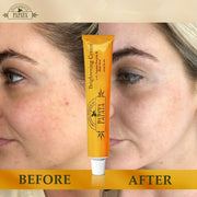 Organic Extract of Papaya Brightening Cream Tube - 50g / 1.76 Oz FleurDeLis - Mitchell Brands - Skin Lightening, Skin Brightening, Fade Dark Spots, Shea Butter, Hair Growth Products